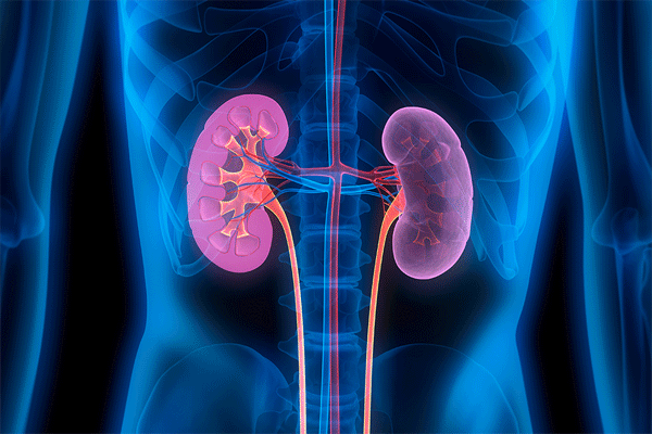 Kidney Failure Symptoms